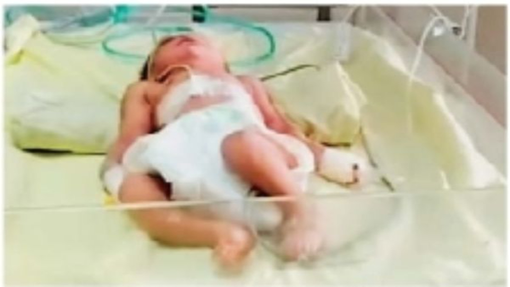 रहस्यमई बुखार से पलवल के एक और गांव में 8 बच्चों ने तोड़ा दम, अब तक 24 की मौत baby baccha