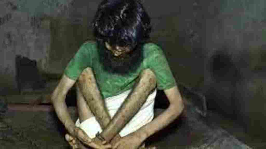 अंबाला में युवक से जानवरों जैसा सलूक, 10 साल तक लोहे की जंजीरों में रहा कैद ambala news 3