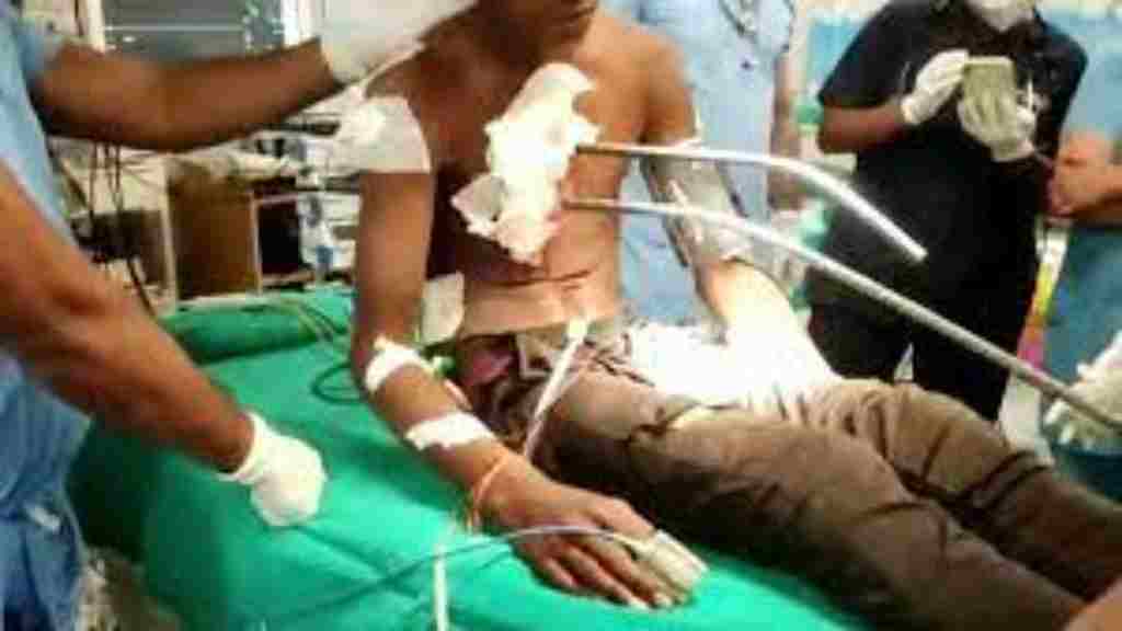 युवक के शरीर में घुसे थे 40 फीट लंबे लोहे के दो सरिए, 5 घंटे के ऑपरेशन में ऐसे बची जान rohtak news