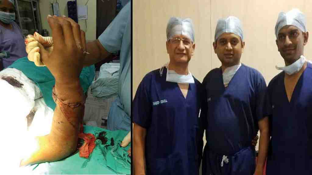 हरियाणा में डॉक्टरों ने जोड़ा कटा हाथ, 10 घंटे चला आपरेशन; अंग कटने पर तुरंत उठाए ये कदम Faridabad Doctor