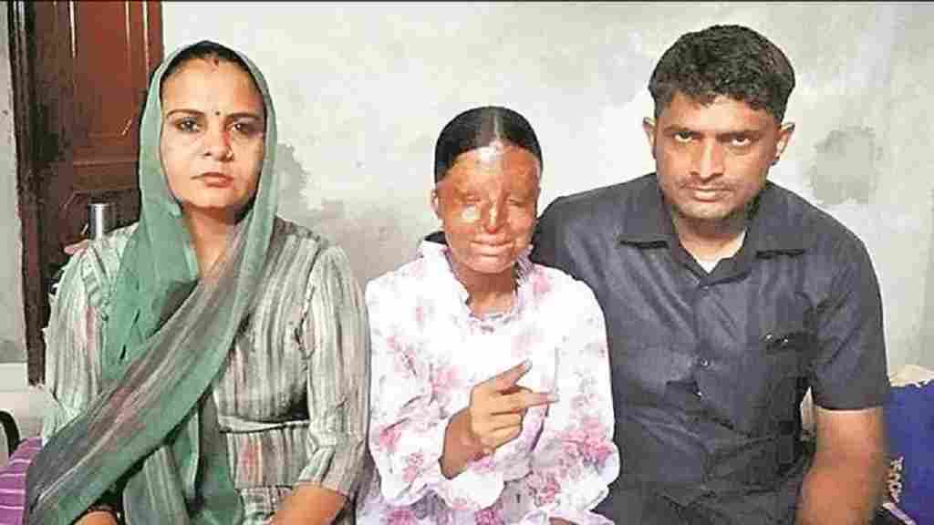 हिसार में होली वाले दिन चेहरे पर हुआ तेजाब से हमला, आंखों की रोशनी गई; अब 10वीं में किया टॉप Kaifi Hisar