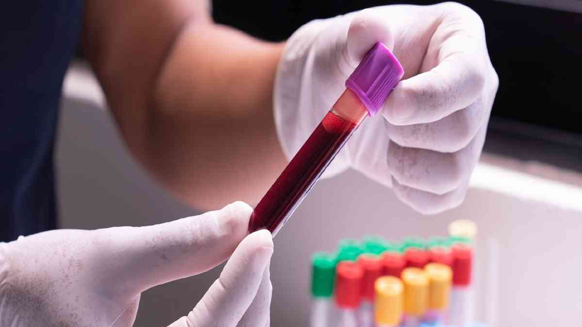 रोहतक: PGI से घर बैठे मिलेगी ब्लड रिपोर्ट, बस करना होगा ये काम Blood Reports Doc